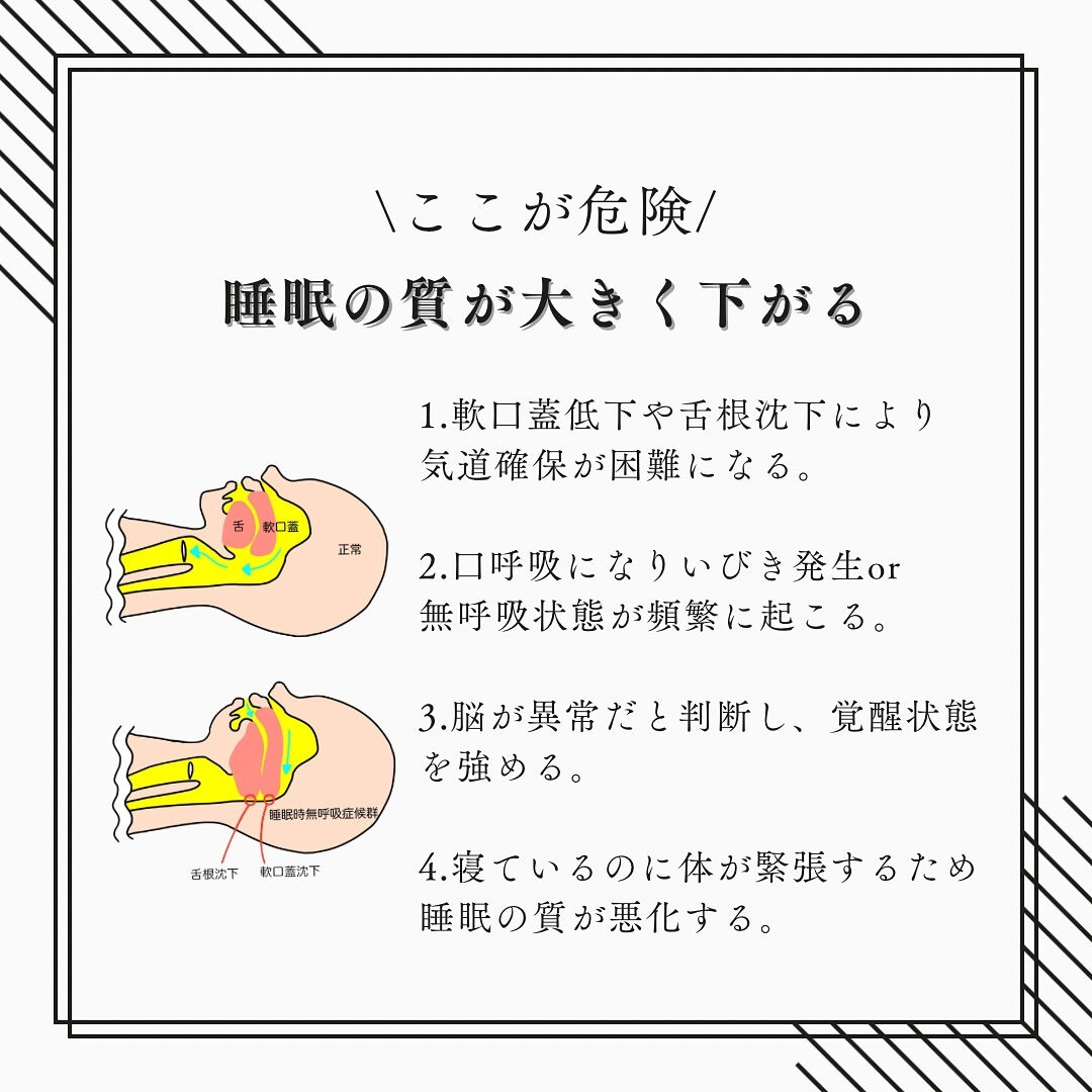 『日中の眠気　睡眠時の呼吸が原因！？』